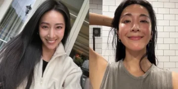 45歲隋棠大方認了做醫美！曬電波術後「真面目素顏照」