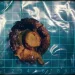 六旬男突發腹痛竟是腸阻塞!醫師開刀取出「整朵香菇」揭原因